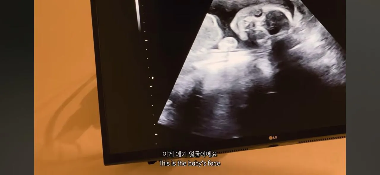 박주호 아내 안나, 넷째 임신?