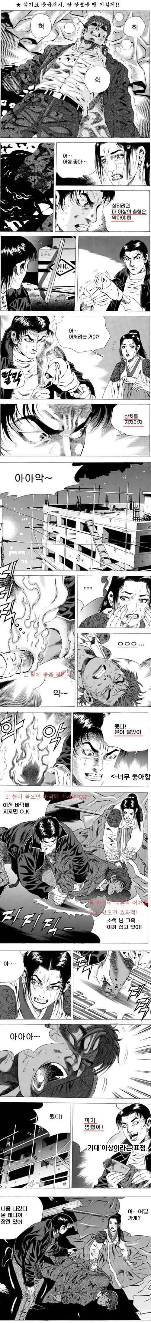 김성모식 응급처치
