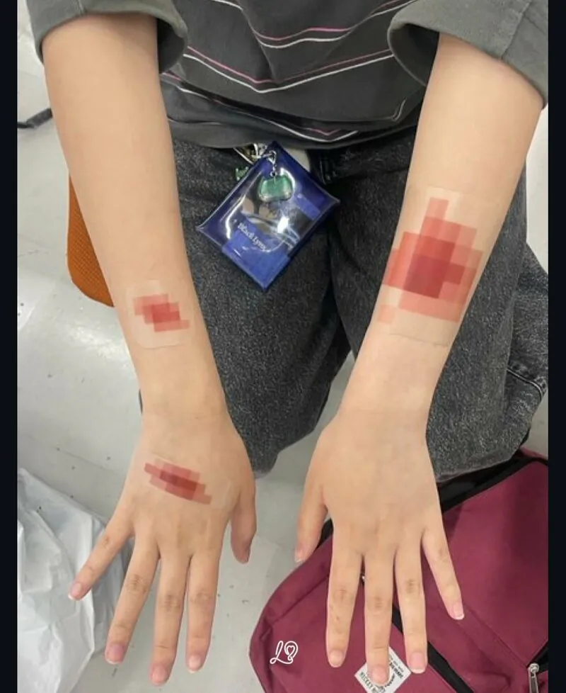 일본에서 나왔다는 반창고 아이디어