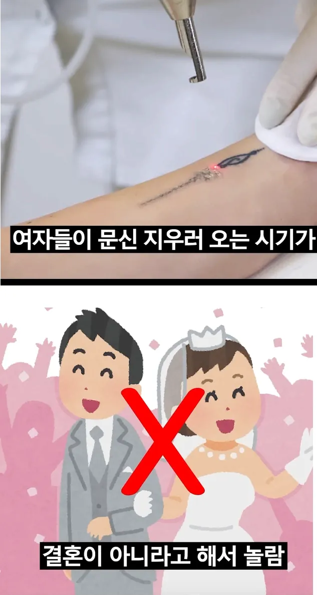 여자들이 문신 지우기로 결심하는 순간