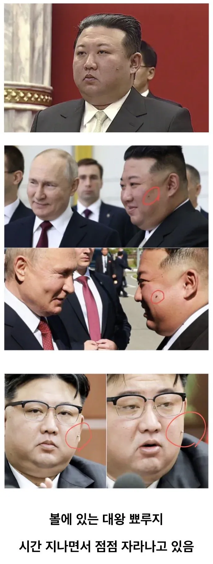 김정은 얼굴에서 점점 자라나고 있는 것